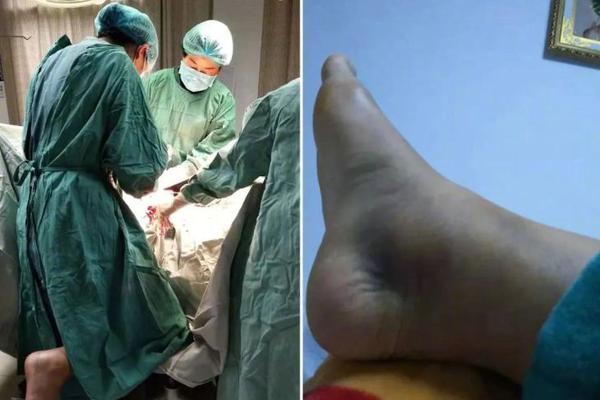 小小梦魇2通关视频流程